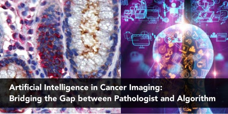 Artificial Intelligence Ai In Cancer Imaging Bridging The Gap Between Pathologist And 6817